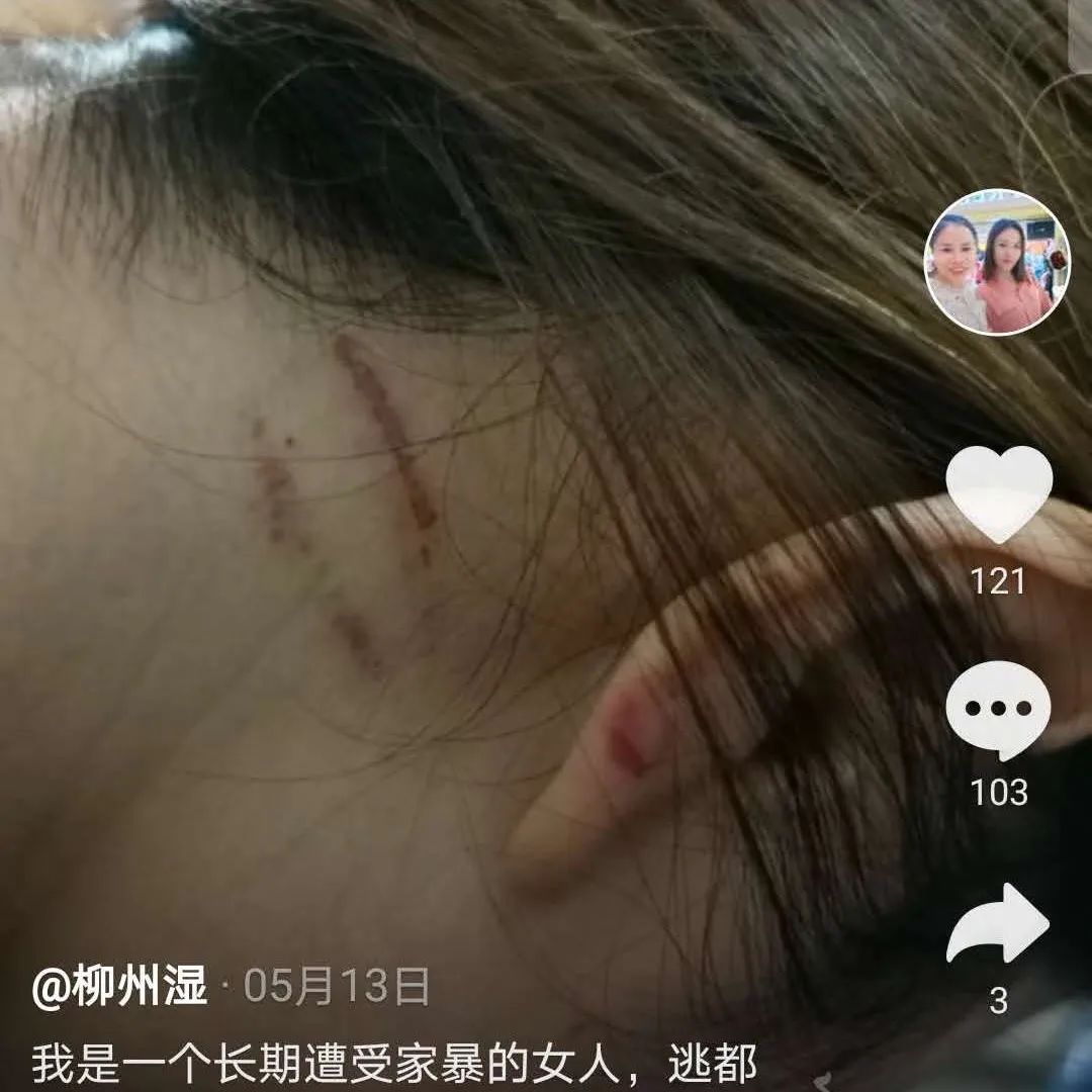 柳州一女子被家暴，拍抖音求救