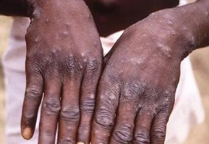 疫情_tag_环球网