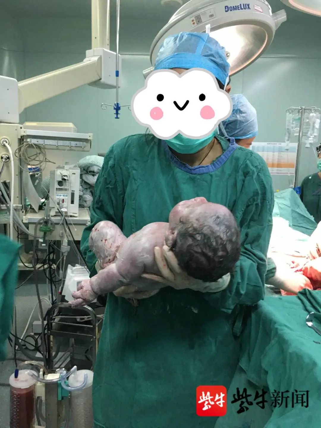若巨大儿低血糖严重而又持续时间长,则会引起神经精神方面的后遗症,如